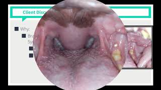 VICE Rounds  Brachycephalic Airway Syndrome See Description For How to Access More Videos [upl. by Anelam255]