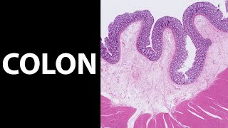 COLON histologie Microscopie van het colon dikke darm [upl. by Adiel483]