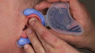 Dont want Cauliflower Ear Cauliflower Ear Prevention in 5 minutes at home [upl. by Cressi212]