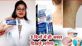 Wart Remover Ointment honest review 2023Wart Remover Ointment benefit usesampsideeffects review hindi [upl. by Ilram409]