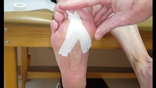 Plantarflexion Taping for Plantar Plate Tears [upl. by Dustie241]