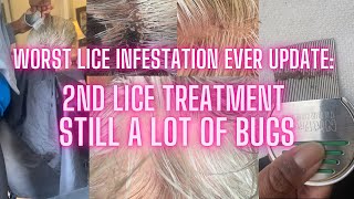 Worst Lice Infestation Update 2nd Lice Treatment l 1000 Of Bugs [upl. by Chrysa]