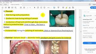 ENDODONTICS ll pulpal and periapical pathosis [upl. by Alyt641]