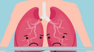 Vídeo 1  ¿Qué es la Fibrosis Quística [upl. by Elehcor493]