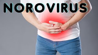 NOROVIRUS Causes Symptoms and Treatments 2024 [upl. by Eylloh]