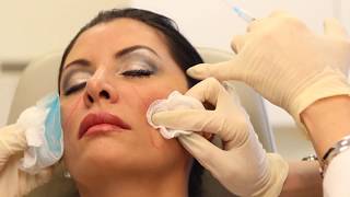 Sculptra Aesthetic  Dermal Filler Injectable  Dr Carolyn Jacob [upl. by Grane568]