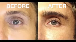 How To Grow Thicker Fuller Eyebrows Brows and Eyelashes for men Fast [upl. by Baldridge609]