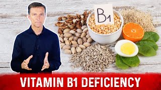 Top Signs and Symptoms of Vitamin B1 Deficiency – Dr Berg [upl. by Arabel]