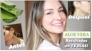 Como usar ALOE VERA en el rostro RESULTADOS en 15 Dias [upl. by Madaras286]