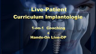 LivePatient Curriculum Implantologie [upl. by Antonella]