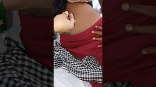 intramuscular tt injection video injection vlog injection video Hip injection video im injection [upl. by Ilamad]