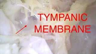 TYMPANIC MEMBRANE [upl. by Yrbua]