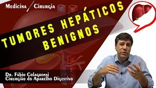 TUMORES HEPÁTICOS BENIGNOS [upl. by Wakeen23]