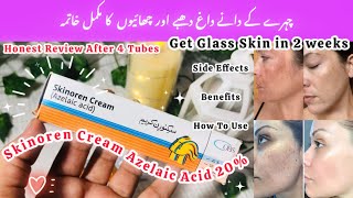 Skinoren Cream Uses and Benefits  How To Use Skinoren Cream  Azelaic Acid Cream Review [upl. by Nosraep]