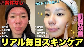 【垢抜け】ニキビ肌からNOトラブル肌になったリアル毎日スキンケアを案件なしで全部見せ！【スキンケア編】 [upl. by Mairhpe]