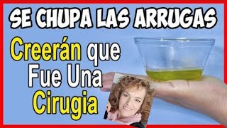 el mejor aceite CHUPA ARRUGAS Y ELIMINADOR DE MANCHAS [upl. by Sergius]