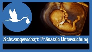 Schwangerschaft Pränatale Untersuchung [upl. by Cestar]