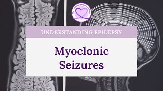 What are Myoclonic Seizures [upl. by Rednaskela]