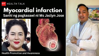 Myocardial infarction Sanhi ng pagkasawi ni Ms Jaclyn Jose [upl. by Joni940]