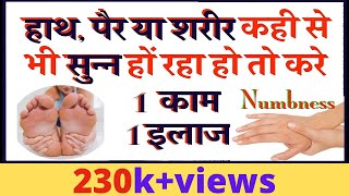 Numbness in Hands and Feet in hindi Reason Treatment  हाथ पैरों का सुन्न होना [upl. by Obeded]