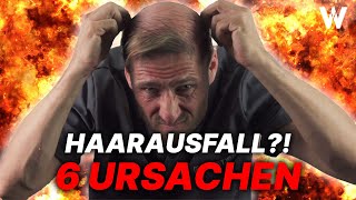 Haarausfall Die 6 häufigsten Ursachen für weniger Haare auf dem Kopf Top Tipps für volleres Haar [upl. by Ninahs440]