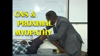 CNS EXAMINATION  PROXIMAL MYOPATHY DR SALAH PACES CENTER [upl. by Ahtibat508]