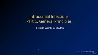 Intracranial infections  1  General principles [upl. by Surovy845]