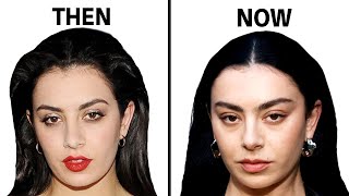 Charli XCX Plastic Surgery Transparency Queen or Not [upl. by Hoashis212]