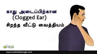 காது அடைப்பிற்கான சிறந்த வீட்டு வைத்தியம்  Home Remedies For Clogged Ears [upl. by Anelim]