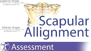 Scapular Alignment and possible causes for dyskinesia [upl. by Anole]