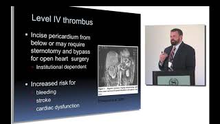 Management and Outcomes in the treatment of Locally Advanced Renal Tumors [upl. by Tedd]