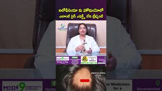 అలోపేసియా కు హోమియోలో ఎలాంటి సైడ్ ఎఫెక్ట్స్ లేని ట్రీట్మెంట్ [upl. by Koa902]