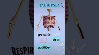 Polipnea vs Taquipnea [upl. by Siusan]