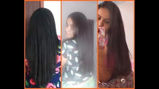 Resultado Anacaps crescimento de cabelo e alopesia [upl. by Carena]