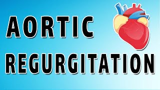 Aortic Insufficiency [upl. by Onitselec]