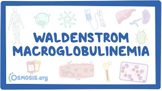 NORD  Waldenstrom Macroglobulinemia [upl. by Onig24]