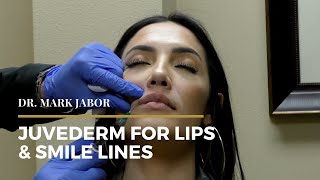 Juvederm Lips amp Smile Lines  Dr Mark Jabor [upl. by Ylliw378]