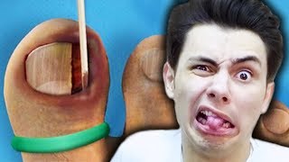 İĞRENÇ KOKULU AYAK AMELİYATI Ingrown Toenail Simulator [upl. by Goth47]