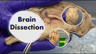 Brain Dissection [upl. by Trinatte]