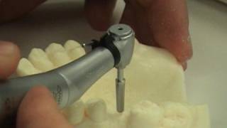 Dental implant surgery training video [upl. by Lahcim435]