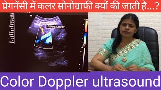 Color Doppler ultrasound pregnancy प्रेगनेंसी में कलर सोनोग्राफी क्यों और कब की जाती है [upl. by Buddie872]