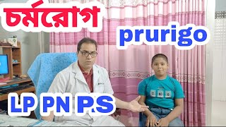 চর্মরোগ স্কিন ডিজিস বাচ্চাদের চর্মরোগ PNPSLPLICHEN PLANUSPRURIGO NODULARISPRURIGO SIMPLEX [upl. by Sachsse793]