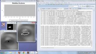 Low Cost Pupillometer [upl. by Orola100]