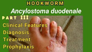 Hookworm  Ancylostomiasis Clinical Features Diagnosis Treatment Prophylaxis  AM Biologie Notes [upl. by Fifine]