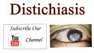 Distichiasis a congenital eyelid abnormality  Optometry Club [upl. by Elsey]