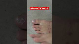 Removing my TOENAIL with a MINIGUN funny science comedy [upl. by Noe]