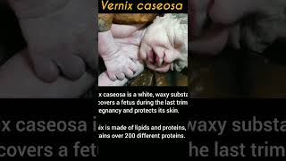 Vernix caseosa newchannel physiotharapy supportme vernixcaseosa baby infant [upl. by Teiluj32]