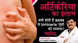 Urticaria पित्ती शीतपित्त उछलने के कारण और ऐसा होने पर कौन सी दवा लेनी चाहिए  Hives Treatment [upl. by Niroc]