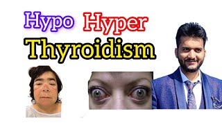 Hypothyroidism vs Hyperthyroidism pna1 satishpatel [upl. by Atenek]