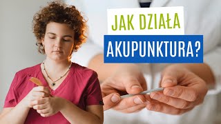 Czy Akupunktura Działa Jak Działa Akupunktura [upl. by Zahara744]